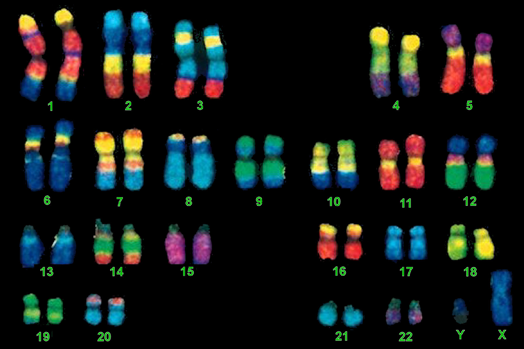 23 хромосомы у человека в клетках. Метод Fish генетика окрашивание хромосом. ДНК, хромосомы, кариотип. Fish метод диагностики кариотипа. Дифференциальная окраска хромосом.